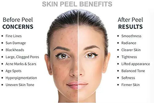 Clarifying Facial Treatment CCB
