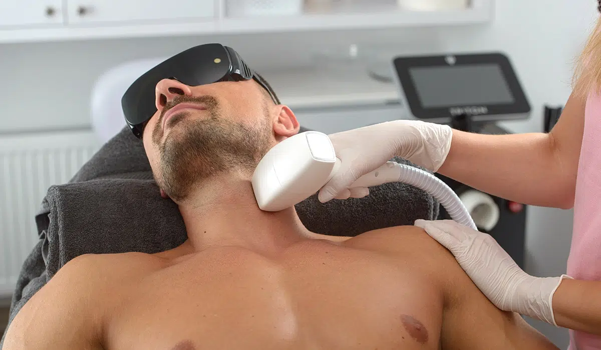 Laser Hair Removal for Men