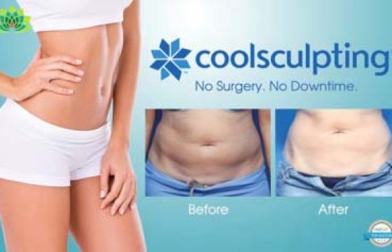 Benefits of CoolSculpting