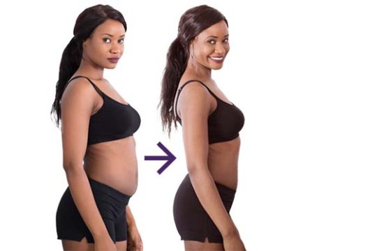 Liposuction Discharge Advice