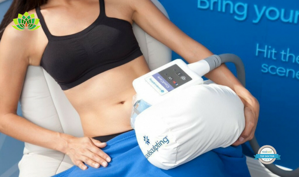 Everything you need to know about CoolSculpting!