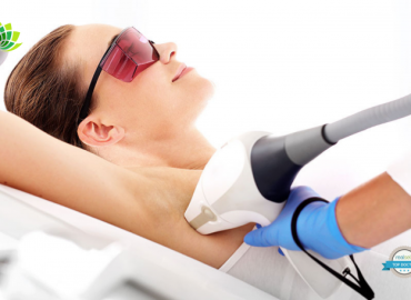 Laser Hair Removal Beginners Guide CCB