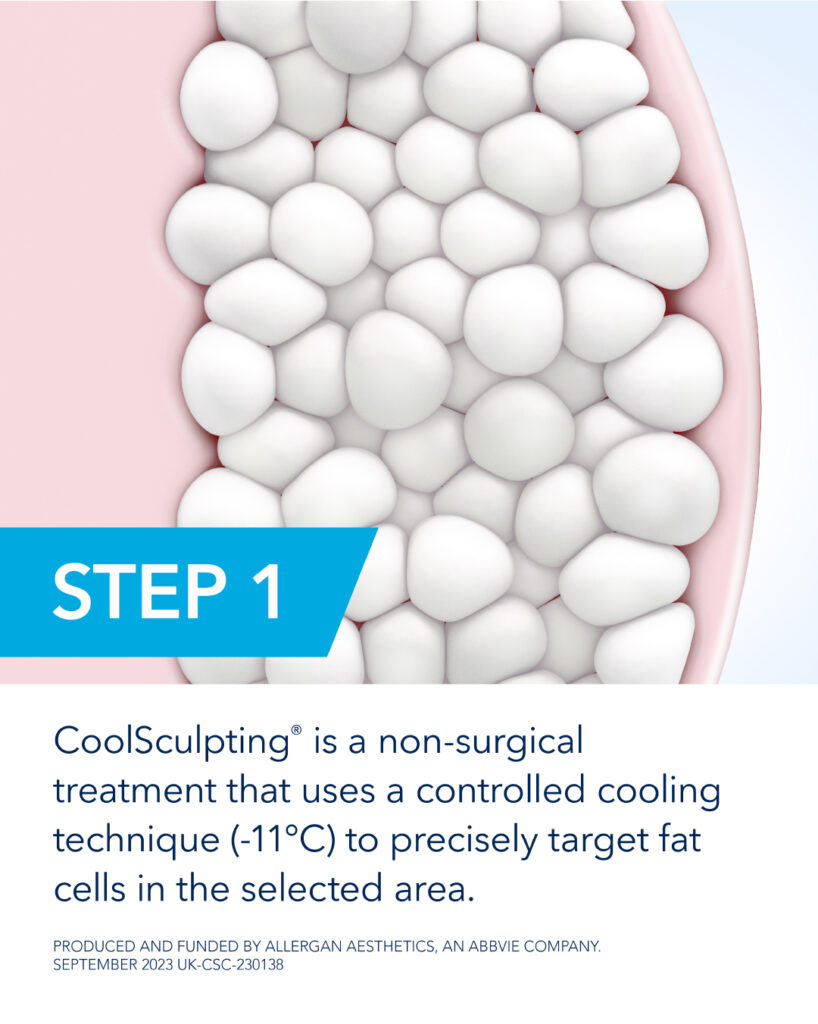 Coolsculpting Fat Freezing Treatment FAQ 1