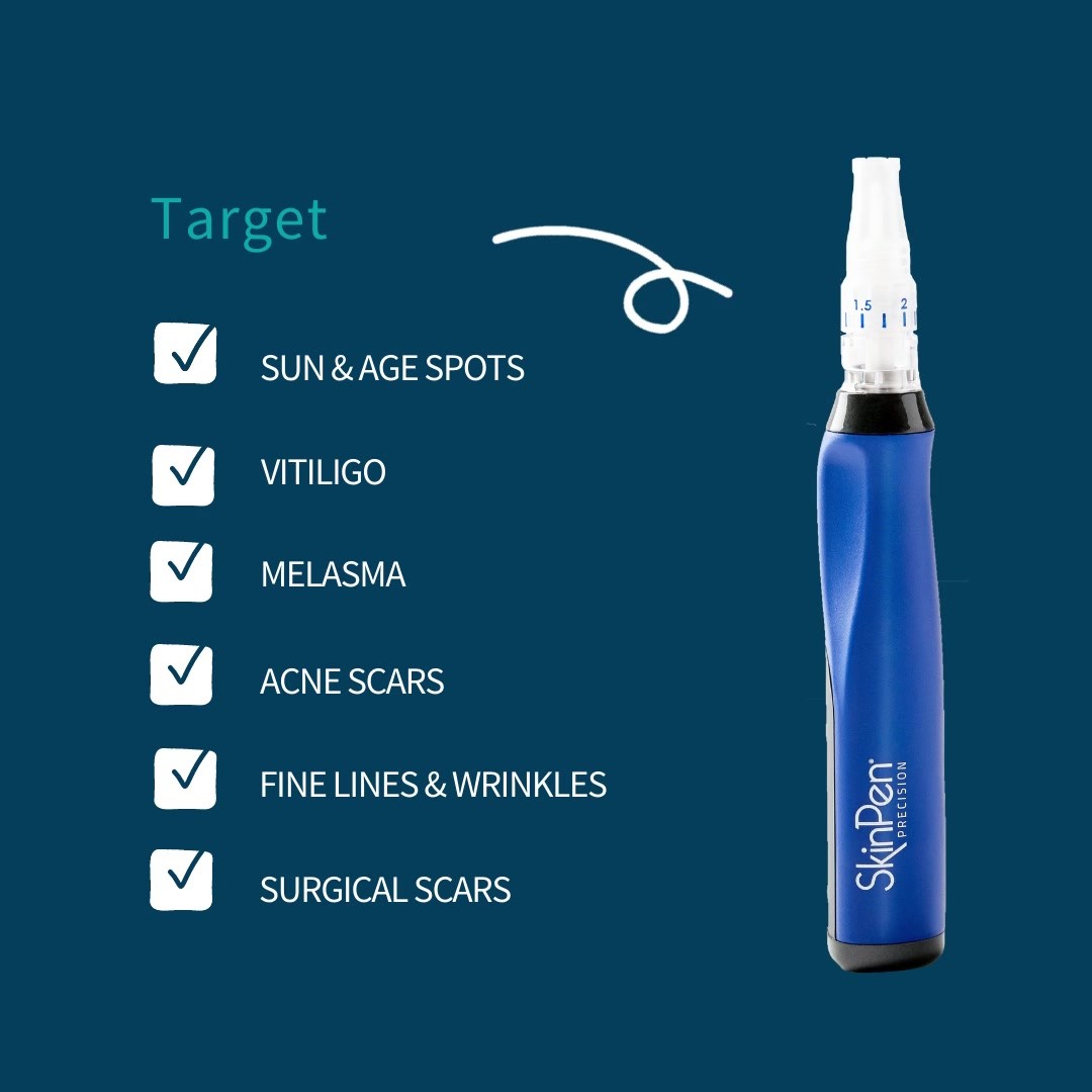 With proven results, @skinpen_uk Precision gives your skin the reset that it needs. Reveal smooth, healthy skin that glows from within.
•
•
•
•
#skinpen #skincare #microneedling #beautifulskin