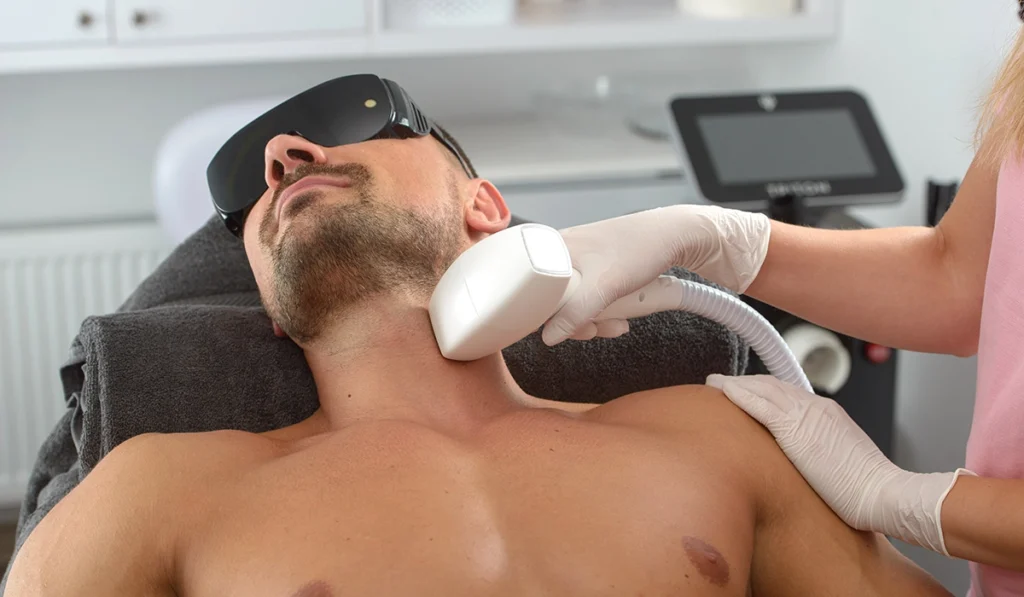 Laser Hair Removal for Men