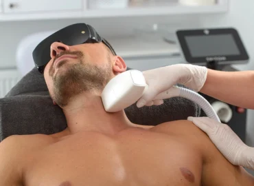 Laser Hair Removal for Men