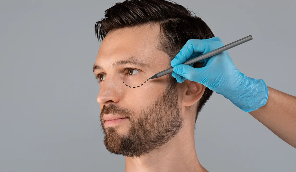 The 1 Stitch Facelift for Men - Cambridge Clear Beauty