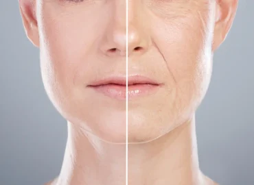 FaceTite Technology