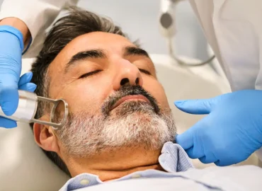 Laser Skin Resurfacing For Men