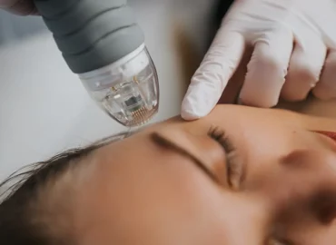 SkinPen Microneedling - Cambridge Clear Beauty