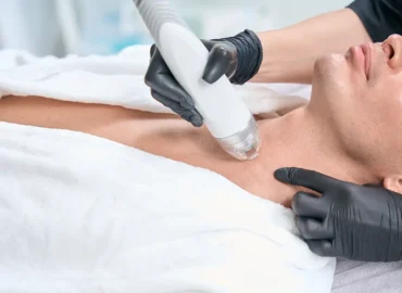 SkinPen Microneedling Session