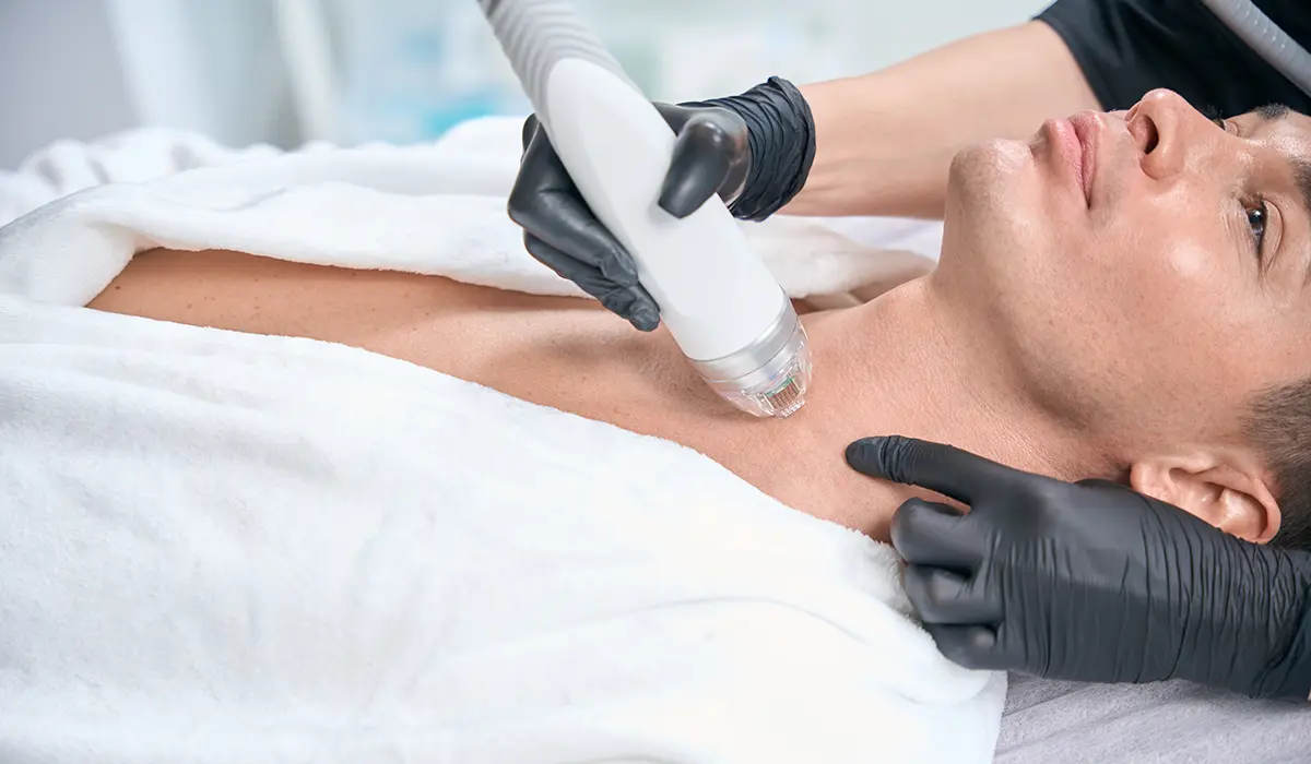 SkinPen Microneedling Session