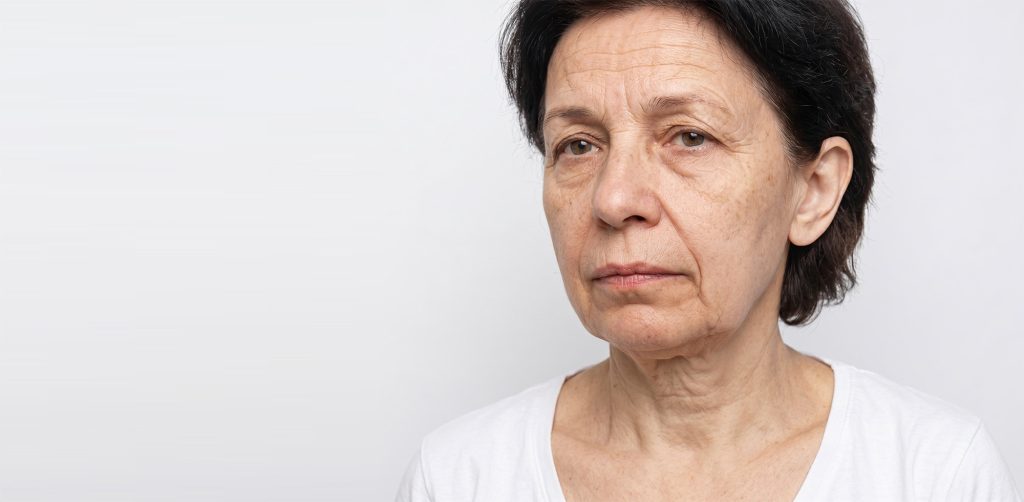 Sagging Skin on Face | Face Skin Tightening Treatment | Loose Skin on Face