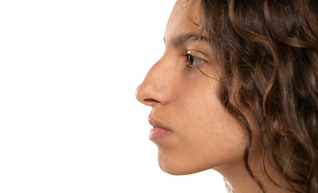 Dorsal Hump Nose | Dorsal Hump Nose Removal Cost | Nose Job Dorsal Hump