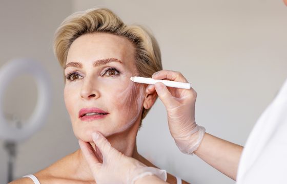 Types of Facelifts | Facelift Types | Facelift Procedures | Facelift Surgery Options