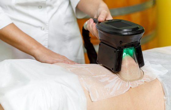 CoolSculpting® Treatments