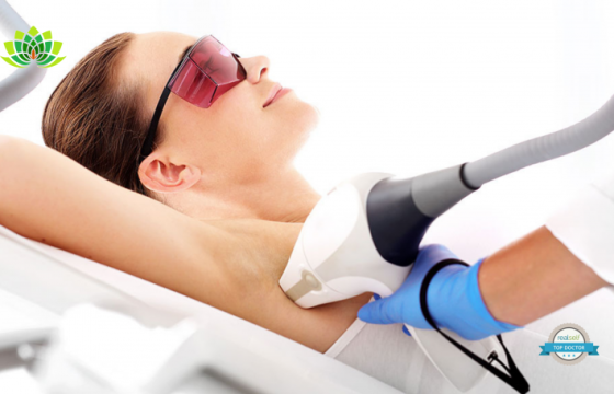 Laser Hair Removal Beginners Guide