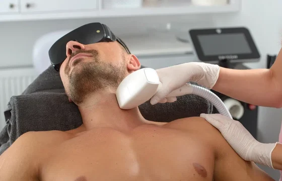 Laser Hair Removal for Men
