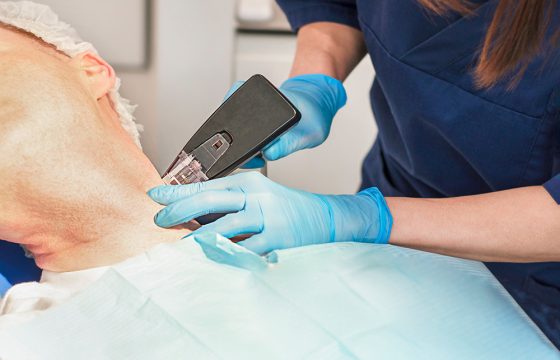 Morpheus8 Nonsurgical Procedure