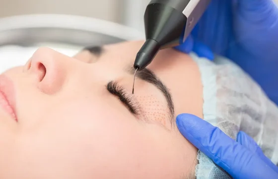 Plasma IQ Non Surgical Eyelift Treatment