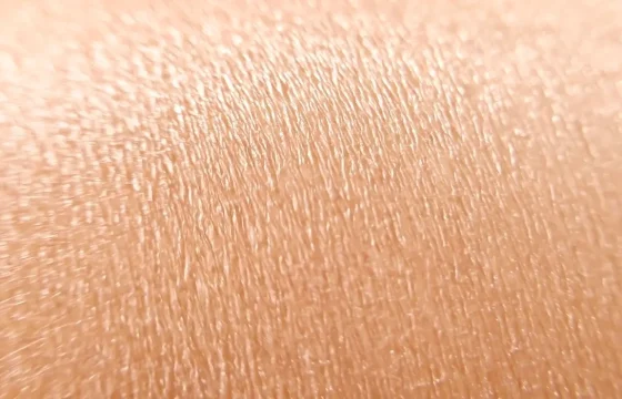 Skin Texture Laser Hair Removal