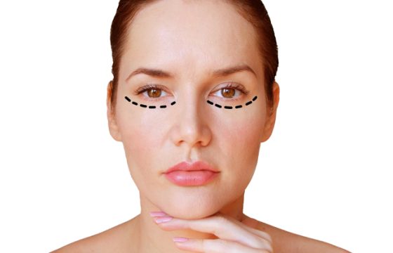 eyelid surgery featured img 4