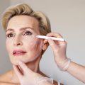 Types of Facelifts | Facelift Types | Facelift Procedures | Facelift Surgery Options